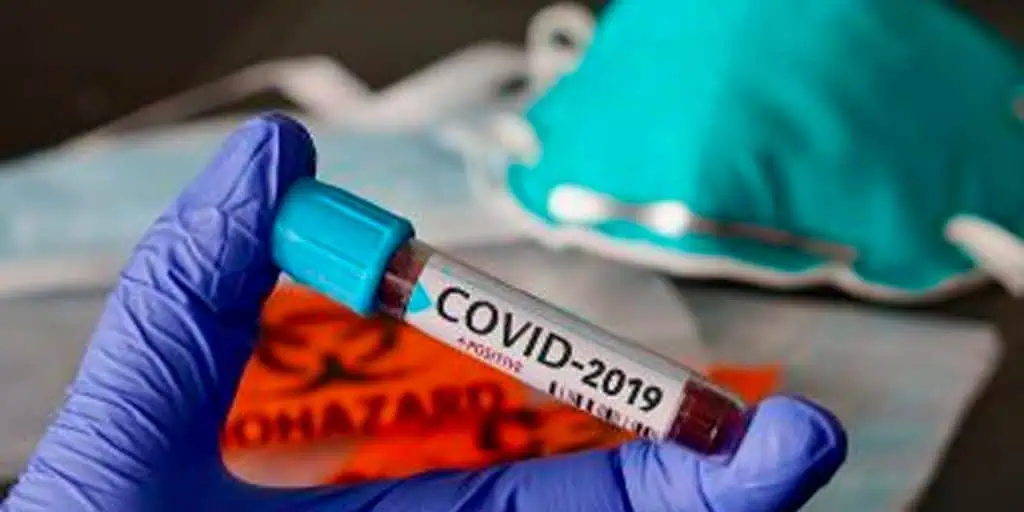 Coalición de empresarios en Colombia adquirirá posibles vacunas contra el coronavirus Esquema de OMS enfrenta riesgo de fracasar y dejar a países pobres sin vacunas hasta 2024