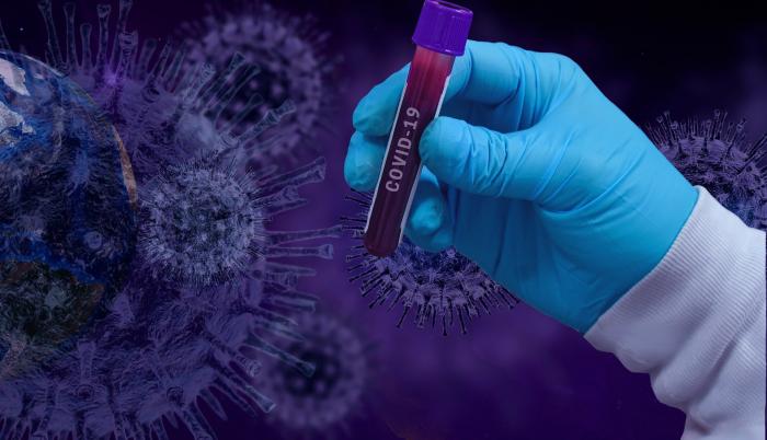 Casos de coronavirus en el mundo superan la barrera de los diez millones