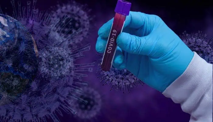 Primeros resultados de vacuna de Novavax contra Covid-19 estarían en julio Casos de coronavirus en el mundo superan la barrera de los diez millones
