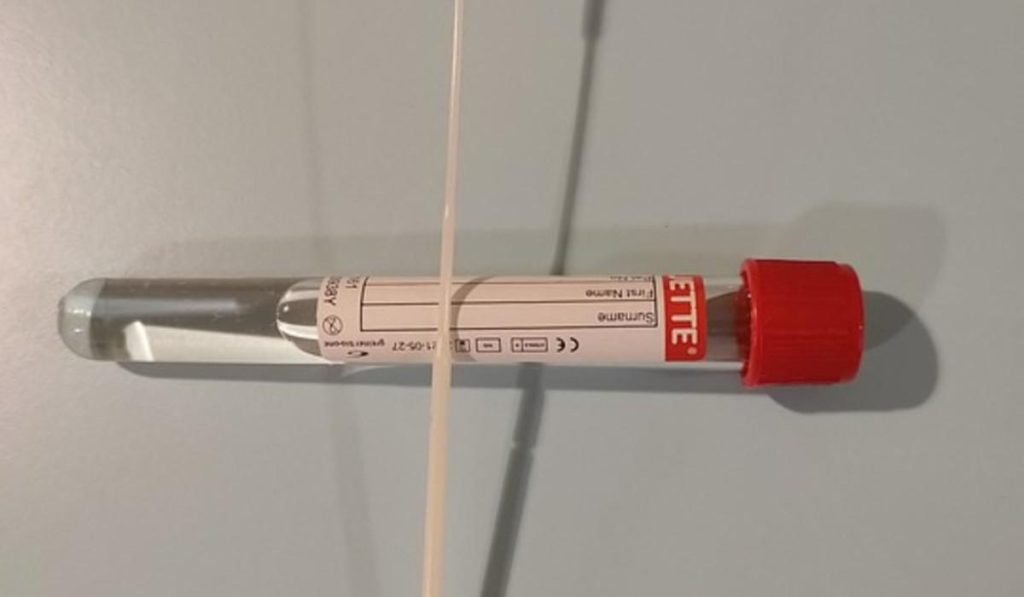Requisito de prueba PCR para viajeros se mantendrá hasta que Minsalud lo indique