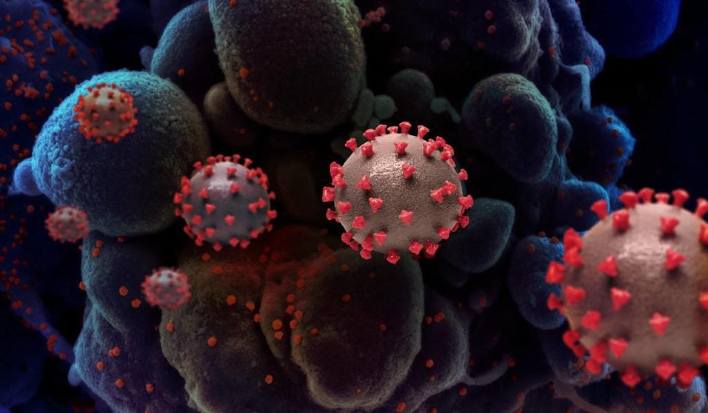 Contagios y muertes por Covid-19 en Colombia siguen a la baja